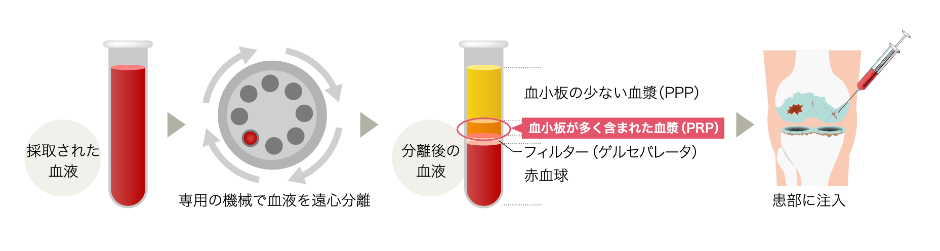 PRP療法が応用できる部位