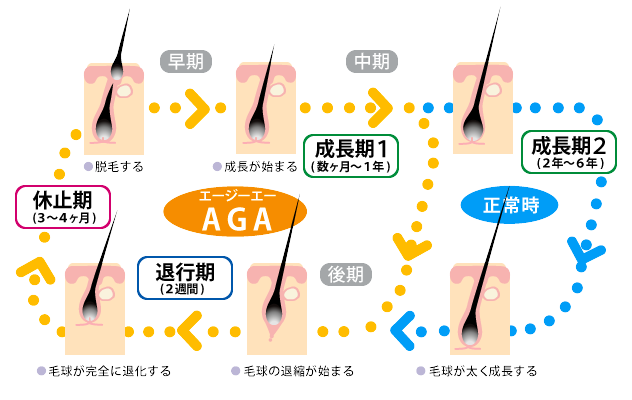 発毛治療