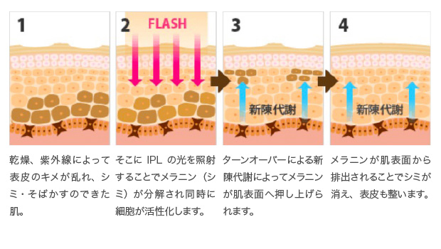 肌のターンオーバー