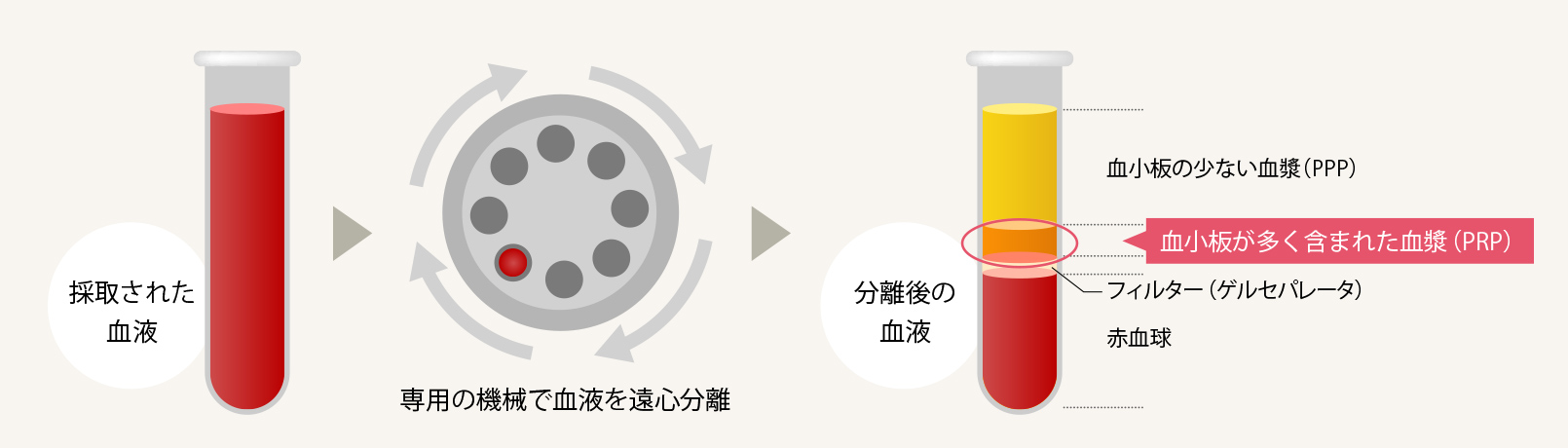 PRP療法とは