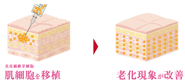 老化現象が改善